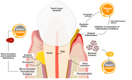 Investigating the Impact of Vitamin D Deficiency on the Mouth, Jaw and Face: A Review Study