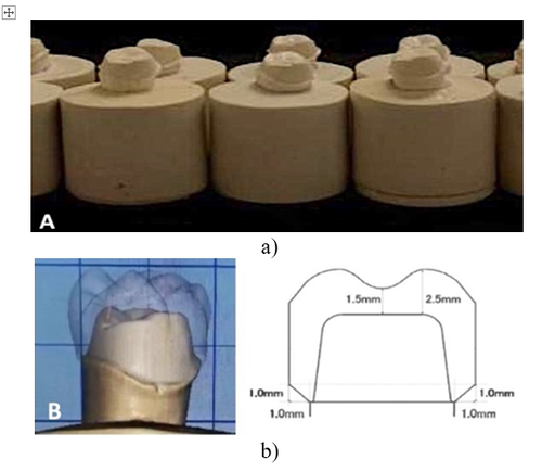 Effect of Luting Agent on the Load-Bearing Capacity of Milled Hybrid Ceramic Single-Tooth Restoration