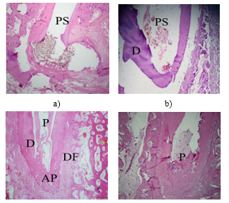 Recombinant Amelogenin Protein Alone Regenerates Lost Tissues in Immature Teeth with Pulp Necrosis and Preapical Periodontitis