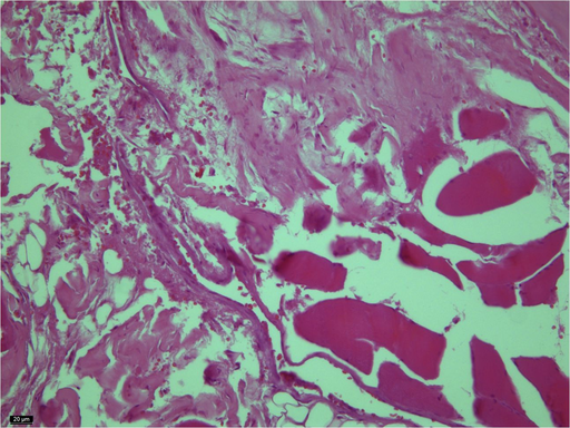 Assessment of Biocompatibility and Bioinertness of Dental Implants Made of Zirconium Dioxide in Vivo