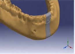 Three-Dimensional Finite Element Analysis of Forces Produced by Different Orthodontic Archwires