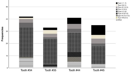 Variations in Permanent Mandibular Premolar Root Canal Configuration: A Cone-Beam Computed Tomographic Study