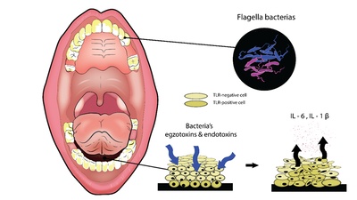 Observational Study of Flagellin, Il-1β, Il-6, And TLR5 in Floor-of-the-Mouth Squamous Cell Carcinoma