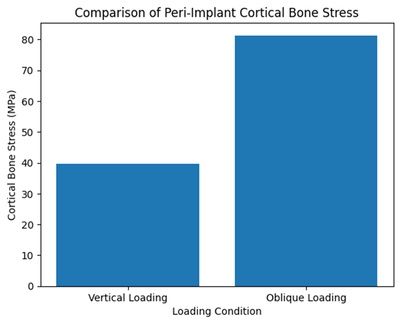 Stress Transfer in Implant-Supported Dentures: A 3d Finite Element Analysis